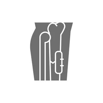 X-ray of broken leg, bone fixed with medical implantable plate grey icon. Stock Illustration