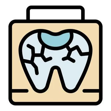 X ray of a broken tooth showing filling and cracks Illustrazione stock