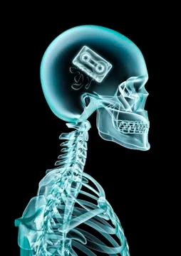 X-ray cassette Иллюстрация