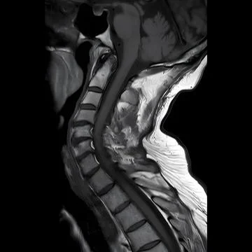 X-ray of the cervical spine Stock-Fotos