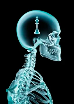 X-ray chess king Illustrazione stock