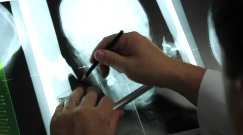 X-Ray Chiropractic Stock Footage 31555048