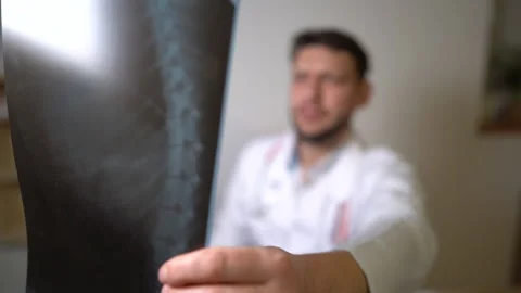 X-ray close portrait in hand of doctor, doctor's face is blurred. X-ray research Stock Footage 145809707