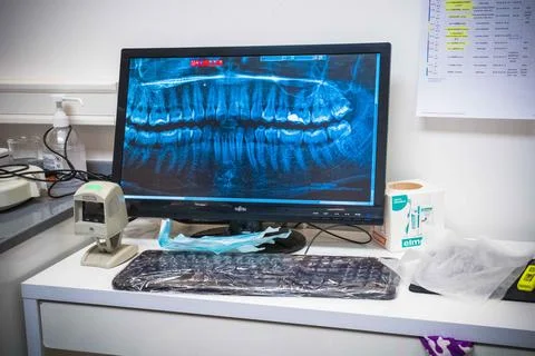 X-ray on computer int the dentist office Stock Photos