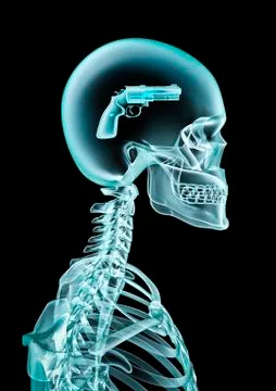 X-ray criminal mind Illustrazione stock