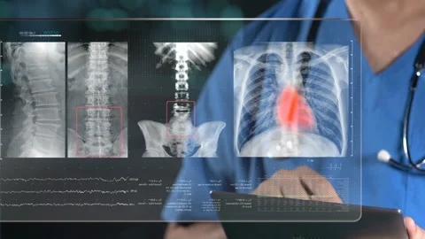  X-ray Data  스톡 동영상 210594862