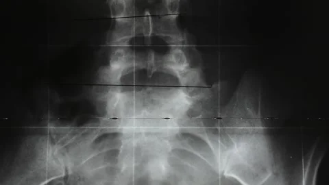 X-ray diagnostic Stock Footage 130243606