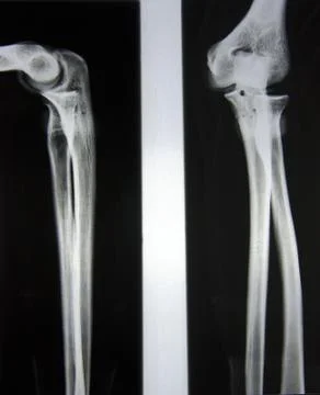 X-Ray Diagnostics Stock Photos