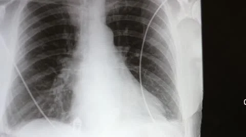 X-Ray with doctors hands 스톡 동영상 21036316