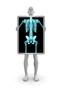 X-ray dude Stock Illustration