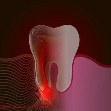 X-ray effect. The transition from a real tooth to a linear x-ray effect with  Stock Illustration