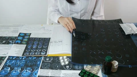 X-ray examination of the brain in the doctor's office Stock-Footage 87478265