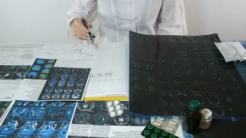 X-ray examination of the brain Stock Footage 87478297