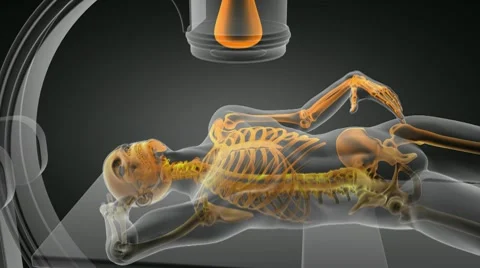 X-ray examination Видео 10804024