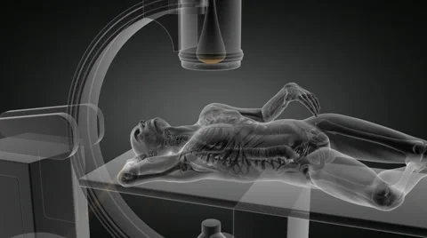 X-ray examination Stock Footage 56450373