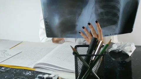 X-ray examination Stock Footage 87483765