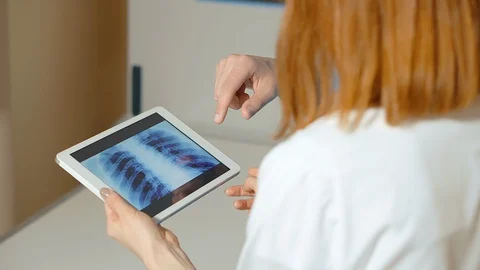 X-ray examination. Vídeo Stock 114155710