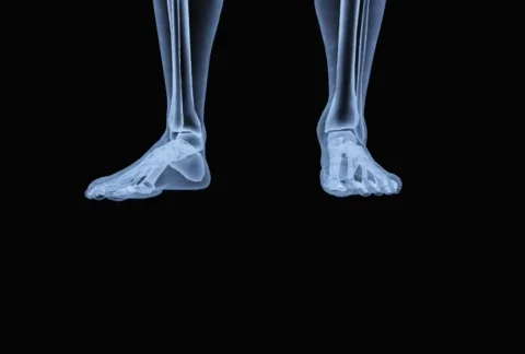 X-Ray from Feet to Head Stock Footage 271479
