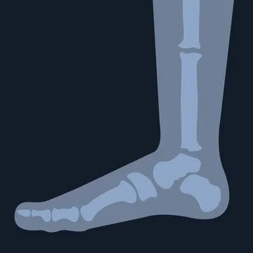 X-ray of the foot skeleton. Human leg bones. Joint anatomy. Stock Illustration