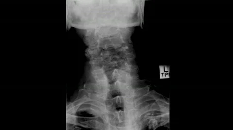 X-ray Stock Footage 530034