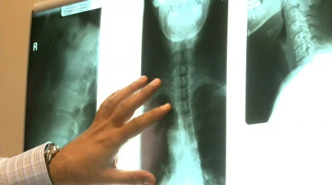 X-ray Video stock 877084