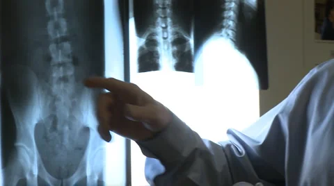 X-ray Vídeo Stock 4765321