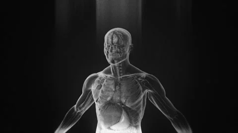 X-Ray Stock Footage 8621107