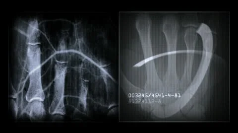 X-ray Stock Footage 10751682