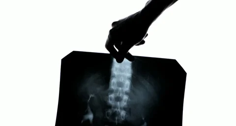 X-ray Stock Footage 103223340