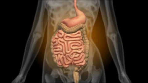 X-ray of the gastrointestinal tract. Radiography of the stomach Stock Footage