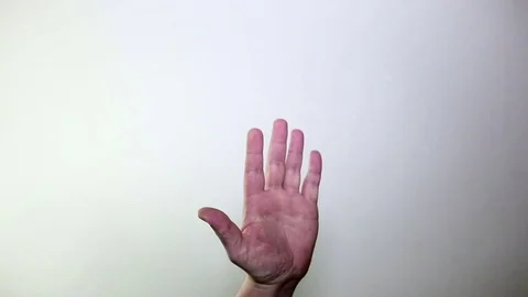 X-ray of hand. Full HD Stock Footage 71985667