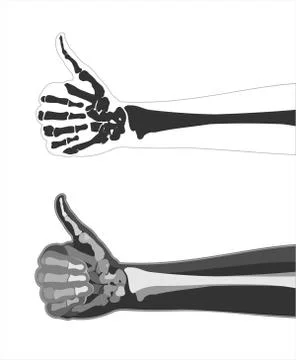 X-ray hand Stock Illustration