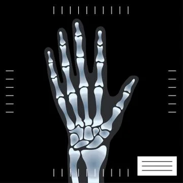 X-ray hand Stock Illustration