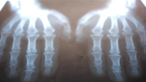 X-ray of the hands on black background Stock Footage 73828156