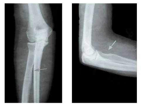 X-ray hands Stock Photos