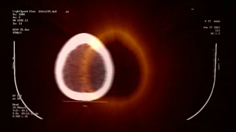 X Ray Head Stock Footage 549154