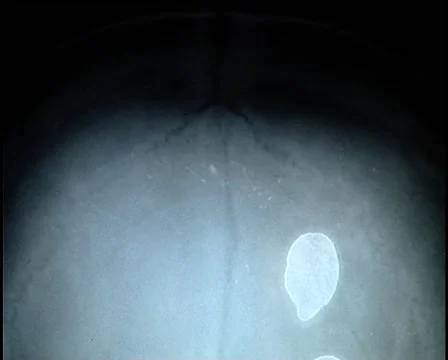 X-Ray head Видео 925532
