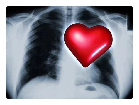 X-ray heart Stock Illustration