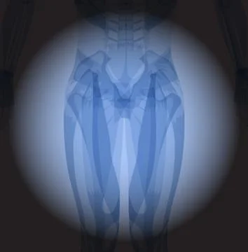X ray hips. Stock Illustration