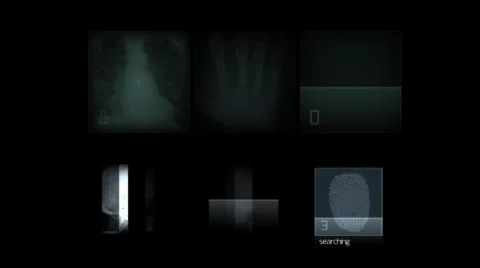 X-ray of human bones. Abstract medical elements.  Alpha channel. Stock-Footage 43976063