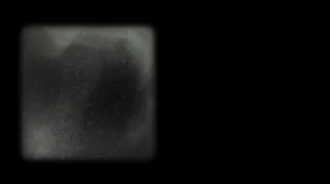 X-ray of human bones. Abstract medical elements. Alpha channel. Stock Footage 43979090