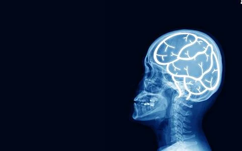 X-ray of human cervical spine and head skull .The sella turcica looks narmal. Stock Photos