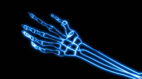 X-Ray Of Human Hand Grasping Stock Footage