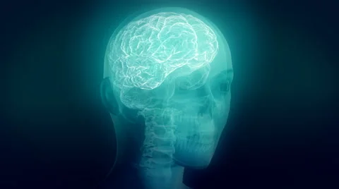 X-ray of human head. Clip A. Loop. Stock Footage 44560152