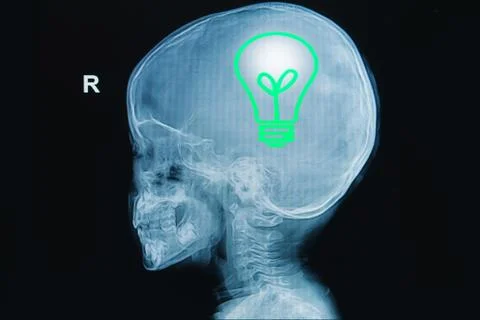 X-ray of human head with light bulb in a brain ,concept think green healty Stock Illustration