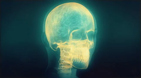 X-ray of human head with skull, spine, brain, veins and nervous system. Loop. Stock Footage 68862149