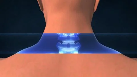 An X-ray of a human neck Stock Illustration