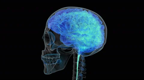 X-ray of human skull with brain being covered with artificial network. Stock Footage 61131884