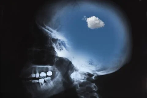 X-ray of human skull with sky Stock Illustration