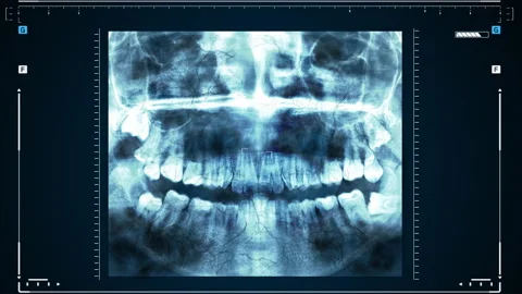X-ray of human teeth or research on dental health. The doctor examines the Видео 154678723